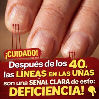 🖐️ Alimentos que Ayudan a Fortalecer las Uñas Después de los 40 Años 💅✨