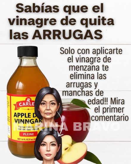 El VINAGRE te rejuvenece 30 AÑOS. Esta Mujer se lo pone y nadie cre que tiene 50 AÑOS