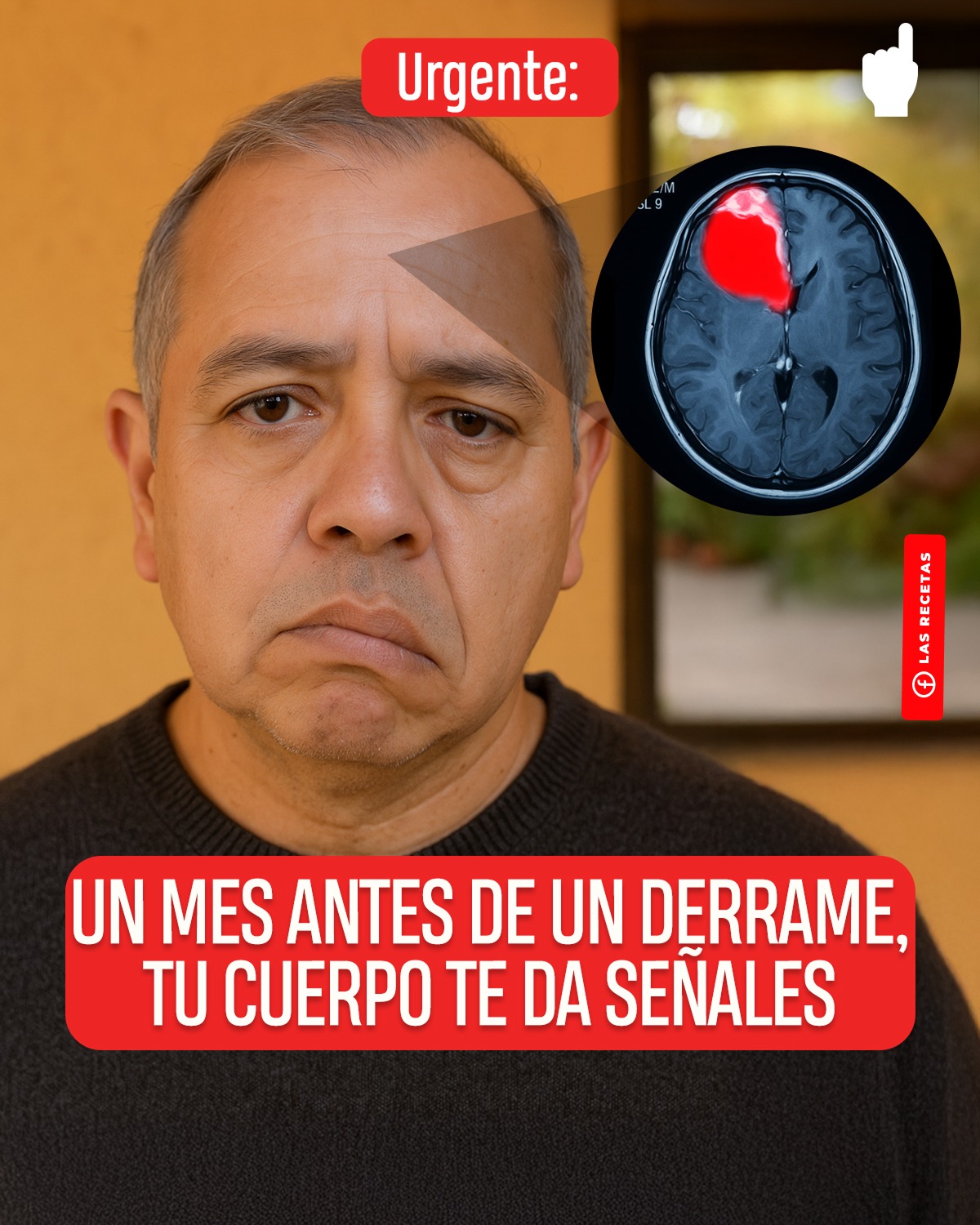 Escucha las Señales de tu Cuerpo! Cómo Detectar un Derrame Cerebral Hasta un Mes Antes
