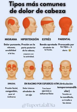En qué momento deberíamos de empezar a preocuparnos por un DOLOR de CABEZA?…..