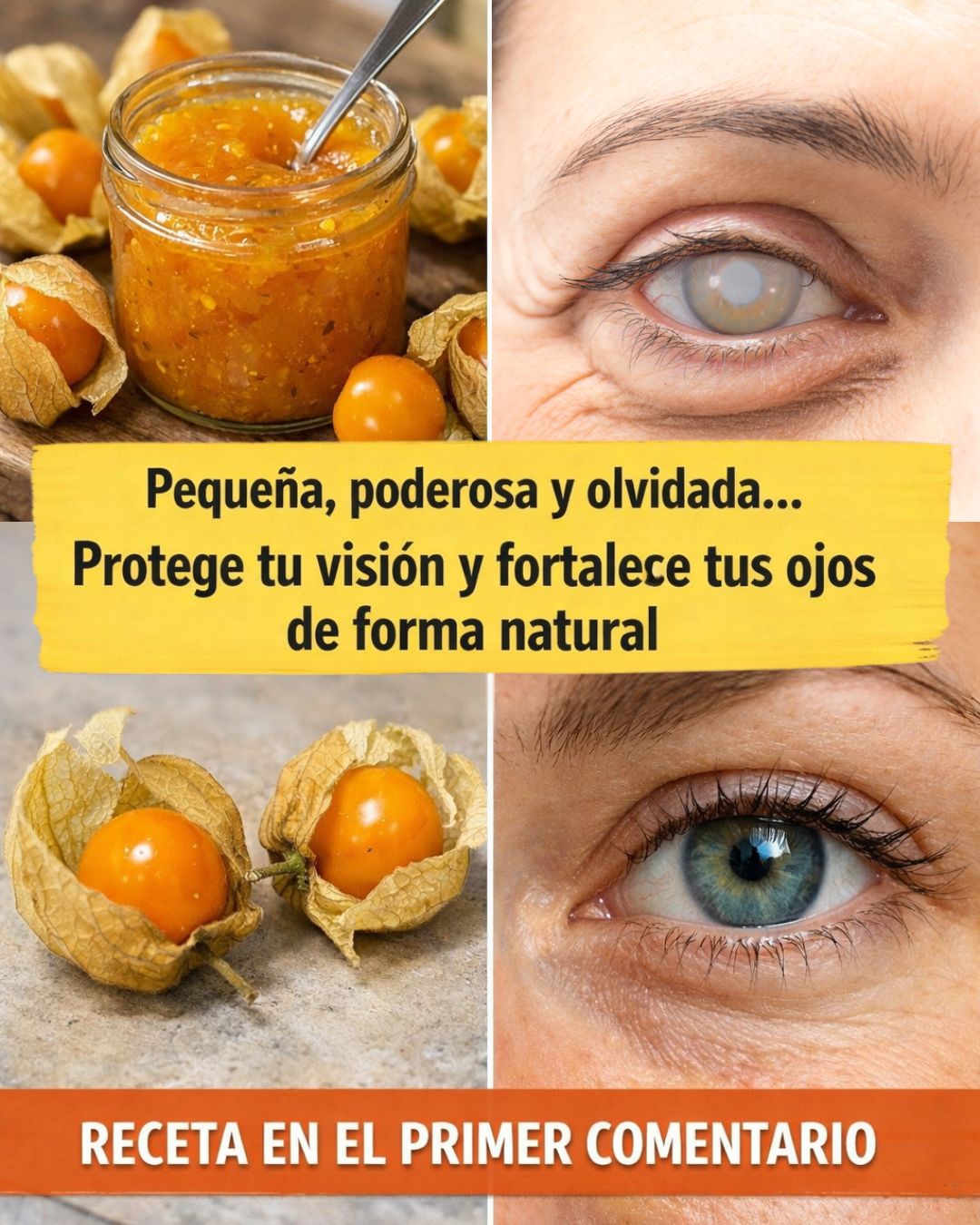 Cómo usar la uchuva para mejorar la visión de forma natural La uchuva, conocida también como aguaymanto, golden berry o physalis peruviana, es una fruta originaria de los Andes que ha ganado popularidad en todo el mundo gracias a sus múltiples propiedades nutricionales. Su sabor agridulce no solo la hace atractiva en la gastronomía, sino que también la convierte en un poderoso aliado para la salud. Uno de sus beneficios menos conocidos, pero de gran importancia, es su impacto positivo en la salud ocular.  Los ojos son órganos extremadamente sensibles, expuestos constantemente a la luz, contaminantes y el envejecimiento natural. Mantenerlos en buen estado requiere nutrientes antioxidantes, vitaminas y minerales, muchos de los cuales están presentes en la uchuva. En este artículo descubrirás cómo utilizarla para mejorar la visión, fortalecer los tejidos oculares y prevenir enfermedades, con recetas prácticas y naturales, además de un repaso completo de sus propiedades y beneficios. Receta 1: Jugo de uchuva para fortalecer la visión  Ingredientes:      1 taza de uchuvas frescas (lavadas).     ½ vaso de agua.     1 cucharadita de miel pura.     ½ limón.  Preparación:      Coloca las uchuvas en la licuadora con el agua.     Añade la miel y el jugo de medio limón.     Licúa hasta obtener una bebida homogénea.     Cuela si deseas una textura más ligera.  Modo de consumo: Tomar un vaso en ayunas, 3 veces por semana, durante 1 mes.  Mysterious Deaths Seemingly Caused By Mummy Curses Detallado… 699 175 233 إذا صرتِ تبكين أكثر مما تبتسمين معه، فقد آن وقت الرحيل Detallado… 307 77 102 Your Partner Should Know These Sensitive Spots Matter Detallado… 560 140 187  Beneficio principal: Aporta vitamina A y betacarotenos que protegen la retina, mejoran la visión nocturna y previenen la degeneración macular.  Receta 2: Infusión de uchuva para la fatiga ocular  Ingredientes:      10 uchuvas maduras.     1 taza de agua caliente.     1 ramita de manzanilla (opcional).  Preparación:      Calienta el agua hasta que hierva.     Tritura ligeramente las uchuvas y agrégalas al agua caliente.     Añade la manzanilla y deja reposar por 10 minutos.     Cuela y endulza con miel si lo prefieres.  Modo de consumo: Tomar una taza en la tarde, especialmente después de largas horas frente a pantallas.  Mysterious Deaths Seemingly Caused By Mummy Curses Detallado… 421 105 140 Your Partner Should Know These Sensitive Spots Matter Detallado… 148 37 49 إذا صرتِ تبكين أكثر مما تبتسمين معه، فقد آن وقت الرحيل Detallado… 88 22 29  Beneficio principal: Reduce la sequedad ocular y el cansancio visual, aportando antioxidantes que combaten el estrés oxidativo.  Receta 3: Batido revitalizante para la retina  Ingredientes:      1 taza de uchuvas frescas.     1 zanahoria mediana.     1 manzana verde.     ½ vaso de agua o leche vegetal.  Preparación:      Lava bien todos los ingredientes.     Pela la zanahoria y córtala en trozos pequeños.     Licúa junto con la manzana y las uchuvas.     Añade agua o leche vegetal hasta obtener un batido cremoso.  Modo de consumo: Beber en el desayuno, 2 a 3 veces por semana.  Mysterious Deaths Seemingly Caused By Mummy Curses Detallado… 242 61 81 إذا صرتِ تبكين أكثر مما تبتسمين معه، فقد آن وقت الرحيل Detallado… 554 139 185 Your Partner Should Know These Sensitive Spots Matter Detallado… 285 71 95  Beneficio principal: La combinación de carotenoides, luteína y zeaxantina ayuda a proteger la mácula, evitando la pérdida de visión con la edad.  Propiedades nutricionales de la uchuva  (En recuadro para destacar) Propiedad	Descripción Vitamina A	Esencial para la visión nocturna y la salud de la retina. Vitamina C	Potente antioxidante que protege las células oculares contra radicales libres. Carotenoides	Ayudan a prevenir cataratas y degeneración macular. Fósforo y hierro	Mejoran la oxigenación ocular y la circulación sanguínea. Polifenoles	Protegen contra la inflamación y el envejecimiento ocular. Luteína y zeaxantina	Filtran la luz azul dañina y protegen la mácula. 20 Beneficios de la uchuva para la salud ocular y general      Protege la retina del daño oxidativo.     Mejora la visión nocturna.     Reduce el riesgo de degeneración macular.     Previene cataratas.     Combate la sequedad ocular.     Fortalece los tejidos del nervio óptico.     Favorece la circulación en los capilares de los ojos.     Ayuda en la recuperación de la vista tras esfuerzos prolongados.     Disminuye la inflamación ocular causada por alergias.     Protege contra el daño de la luz azul de pantallas.     Refuerza el sistema inmunológico ocular.     Mejora la hidratación de la córnea.     Contribuye al mantenimiento de una buena visión en la vejez.     Aporta antioxidantes que previenen el envejecimiento prematuro.     Favorece la cicatrización ocular tras irritaciones leves.     Potencia la absorción de nutrientes esenciales para los ojos.     Disminuye el riesgo de infecciones oculares.     Ayuda en casos de visión borrosa leve por fatiga.     Promueve la elasticidad de los vasos sanguíneos oculares.     Brinda energía y vitalidad general al organismo.  Precauciones al consumir uchuva      No consumir en exceso: su consumo exagerado puede causar acidez estomacal.     Evitar si está verde: las uchuvas inmaduras contienen alcaloides que pueden ser tóxicos.     Personas con gastritis o reflujo deben consumirlas con moderación.     En caso de alergias alimentarias, probar pequeñas cantidades primero.     No reemplaza el tratamiento médico en enfermedades oculares graves.  Conclusión  La uchuva es mucho más que una fruta exótica. Gracias a su riqueza en vitamina A, carotenoides, luteína y antioxidantes, se convierte en una aliada natural para la salud de los ojos. Preparada en jugos, infusiones o batidos, fortalece la visión, previene enfermedades degenerativas y combate el cansancio visual.  Incluirla de forma moderada y constante en la dieta puede marcar una gran diferencia en la protección ocular, especialmente en una época en la que la exposición a pantallas y la contaminación amenazan nuestra vista cada día. Comentarios