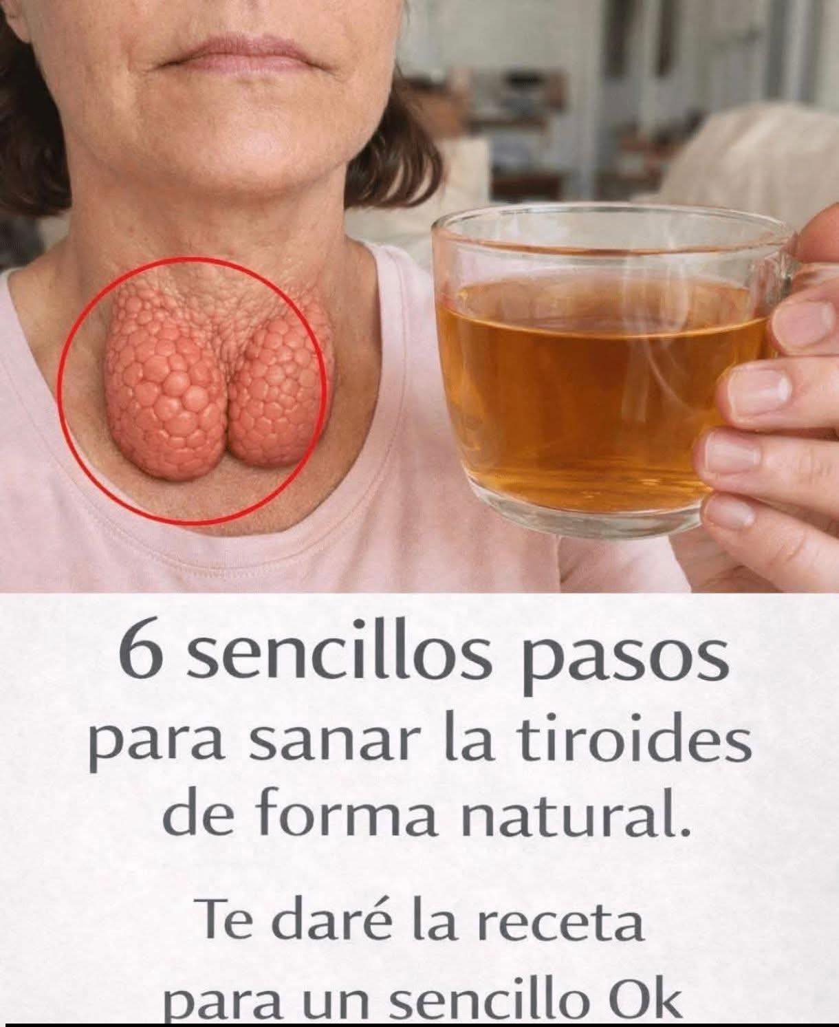 Remedios para curar las glándulas tiroides