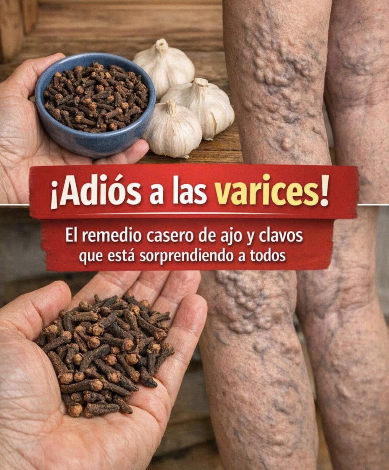 EL AJO Y LOS CLAVOS DE OLOR: