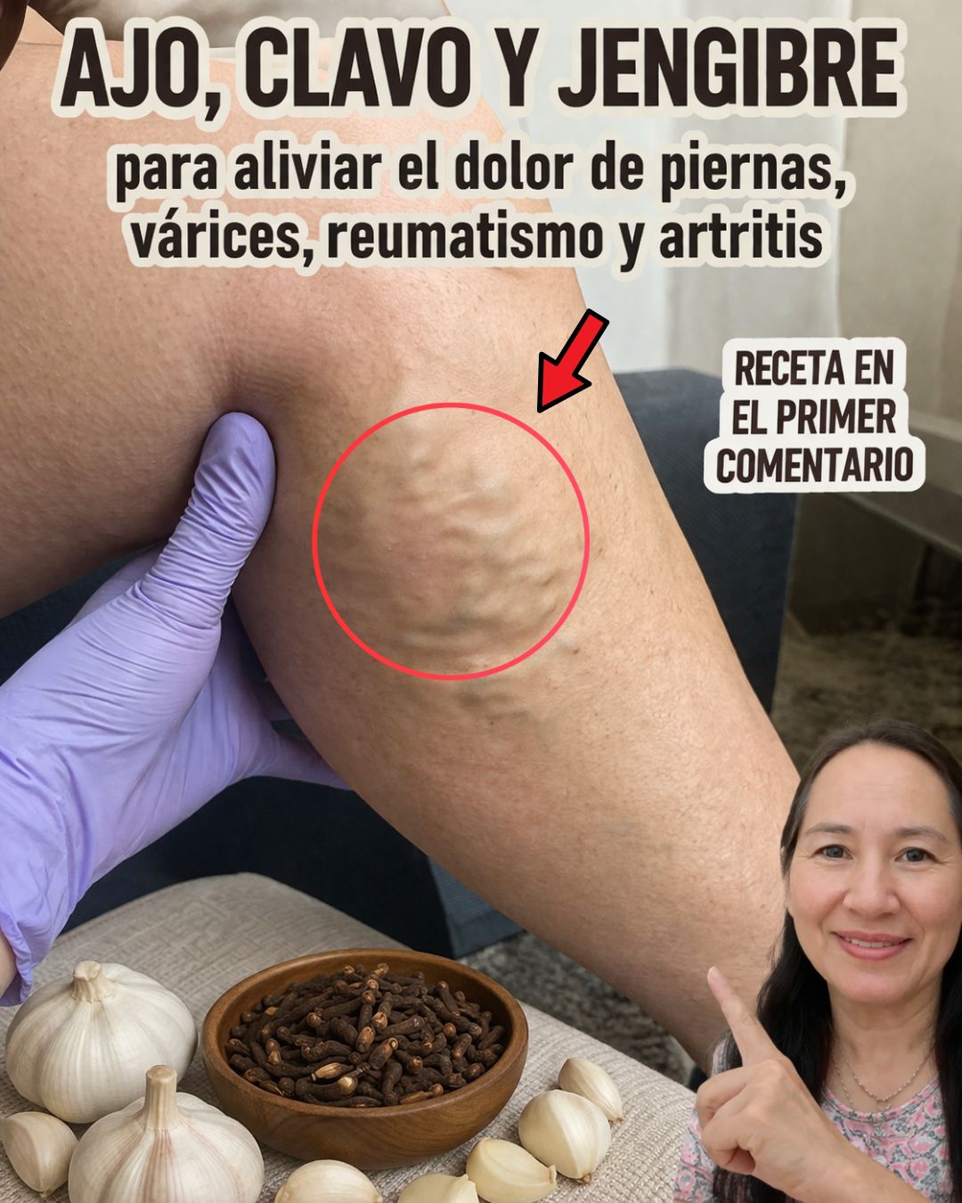Ajo y Clavos de Olor: El Remedio Natural para las Várices y la Circulación