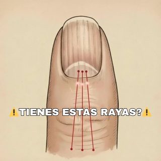 Si tienes las uñas con estas lineas debes poner atención