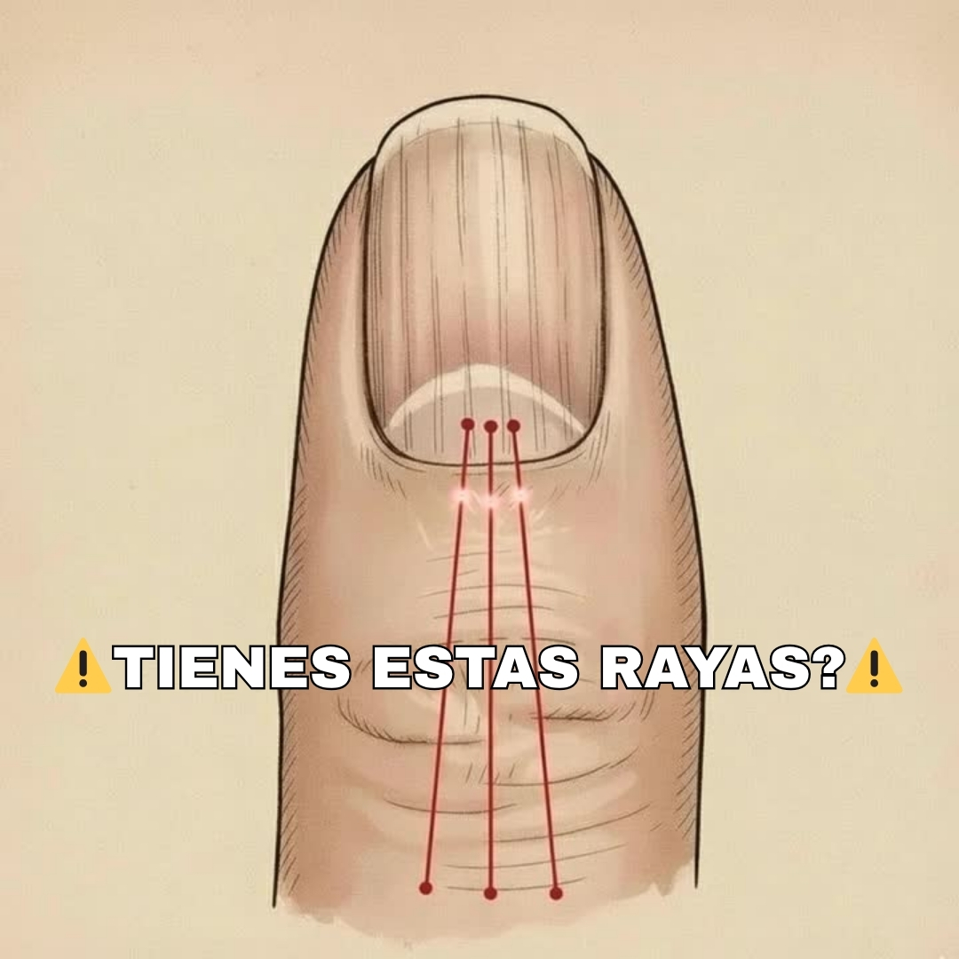 Si tienes las uñas con estas lineas debes poner atención