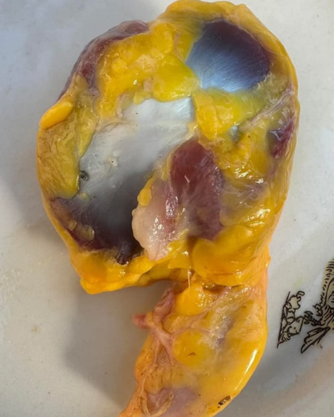 Sabías que si consumes las mollejas de pollo no tienes que tomar…