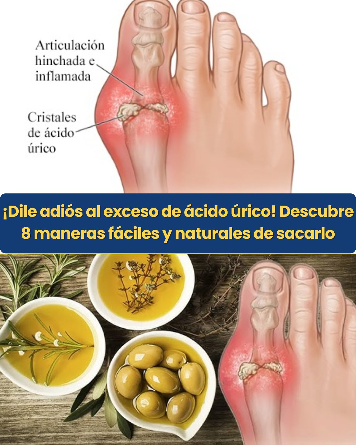 8 Remedios Naturales para Reducir el Ácido Úrico