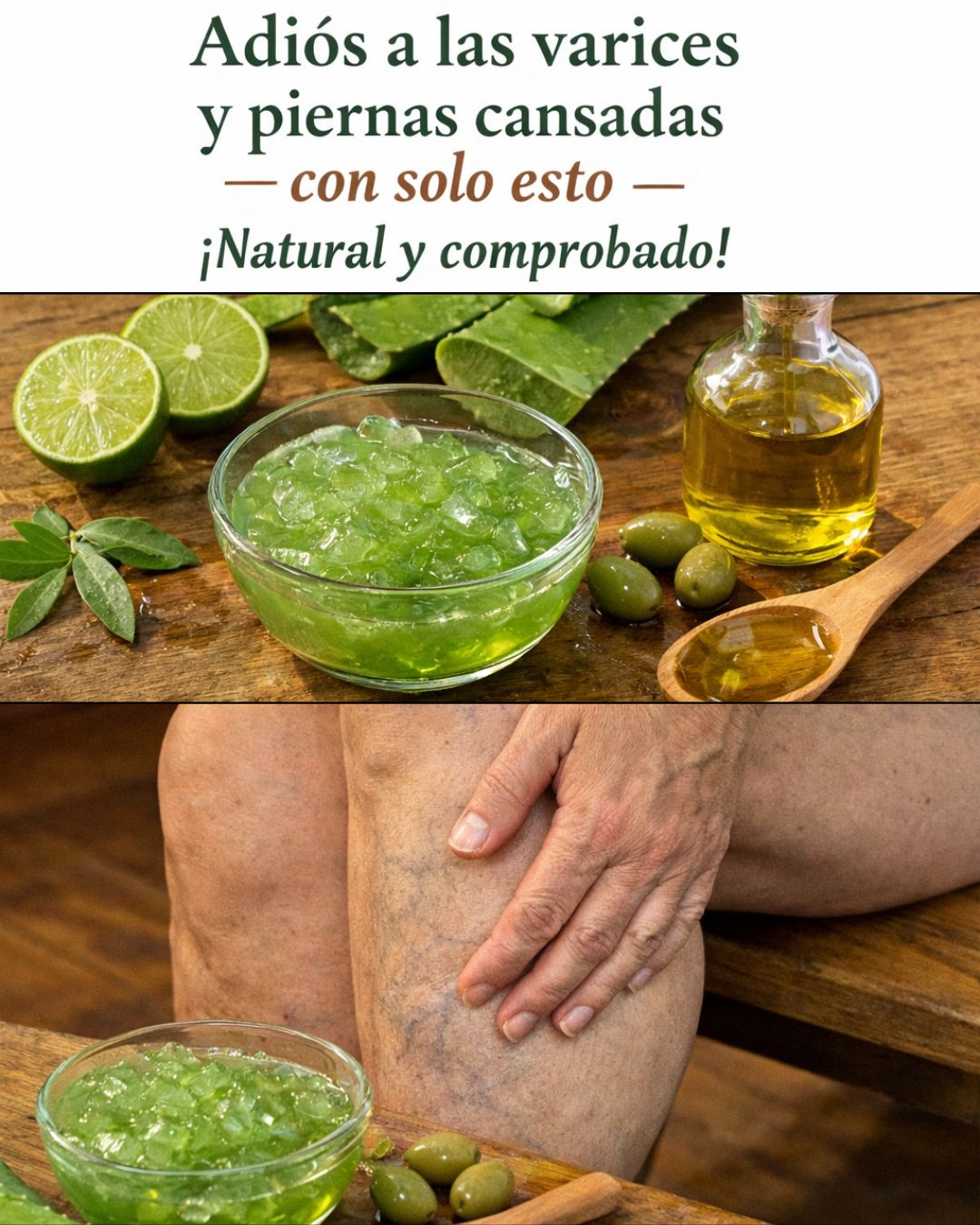 Remedio casero con aloe vera para aliviar varices y piernas cansadas