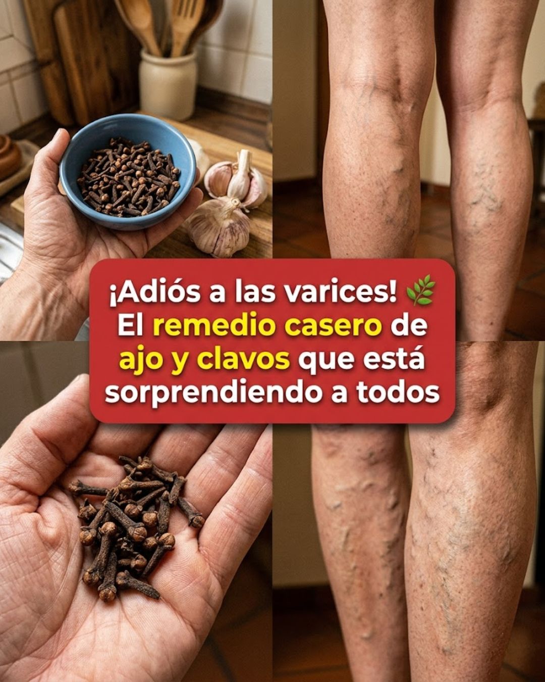 Ajo y Clavos de Olor: El Remedio Natural para las Várices y la Circulación