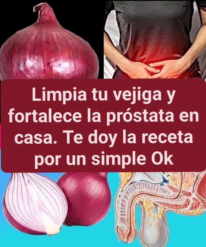 La cebolla