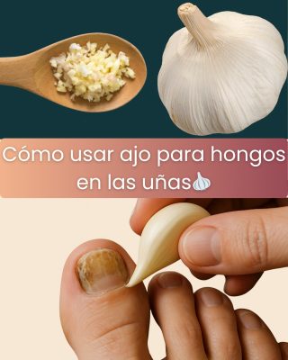 Ajo para Hongos en la Cabeza, Manos, Uñas y Pies