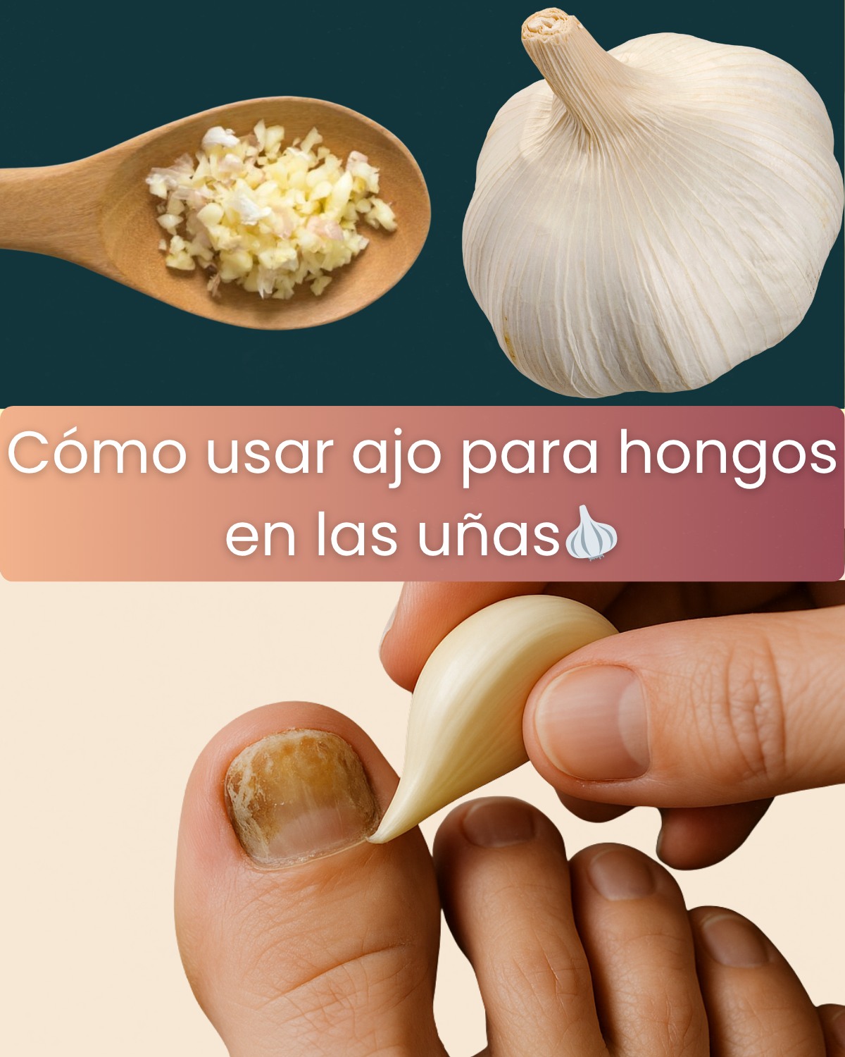 Ajo para Hongos en la Cabeza, Manos, Uñas y Pies