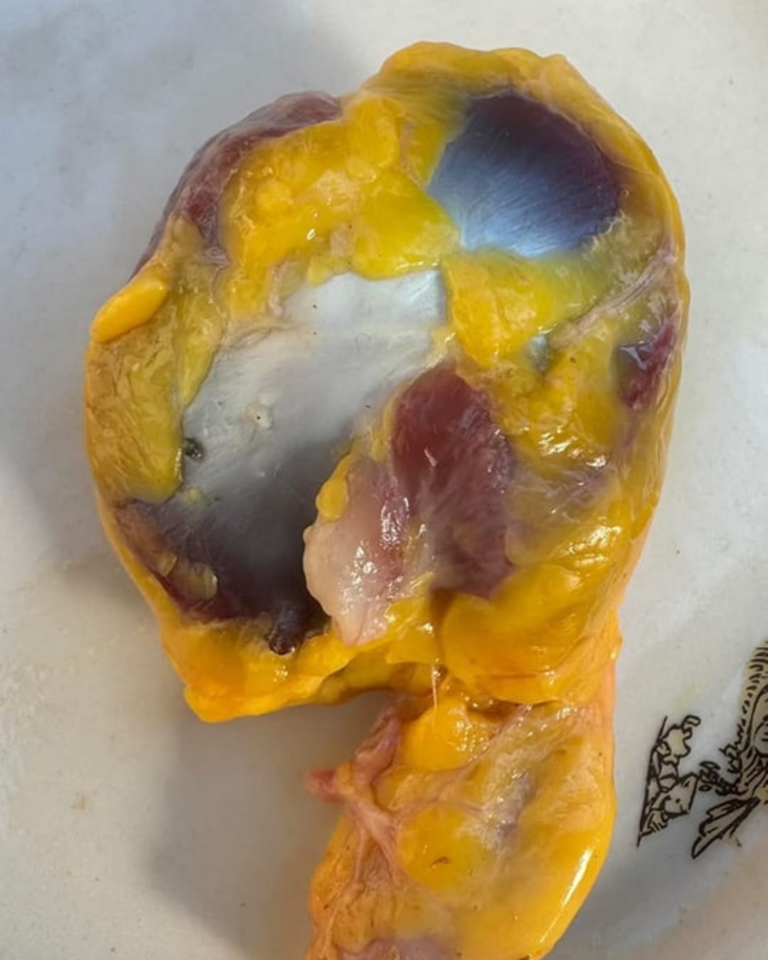 Sabías que si consumes las mollejas de pollo no tienes que tomar…
