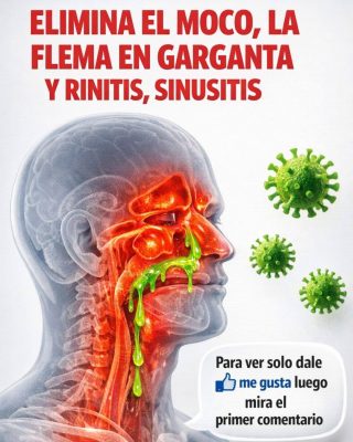 Elimina el Moco, la Flema en la Garganta y Nariz, y la Rinitis: Remedios Caseros