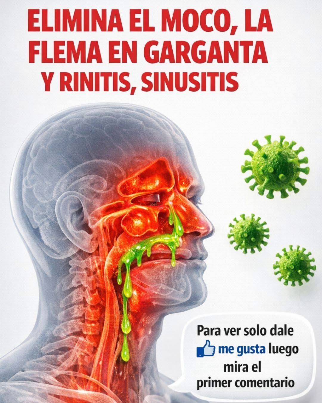 Elimina el Moco, la Flema en la Garganta y Nariz, y la Rinitis: Remedios Caseros