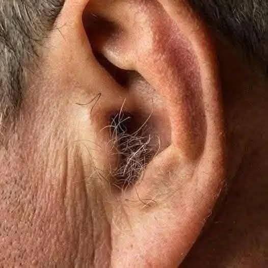 ¿SABÍAS QUE? Si te crece pelo en las orejas, es porque tu cuerpo está…