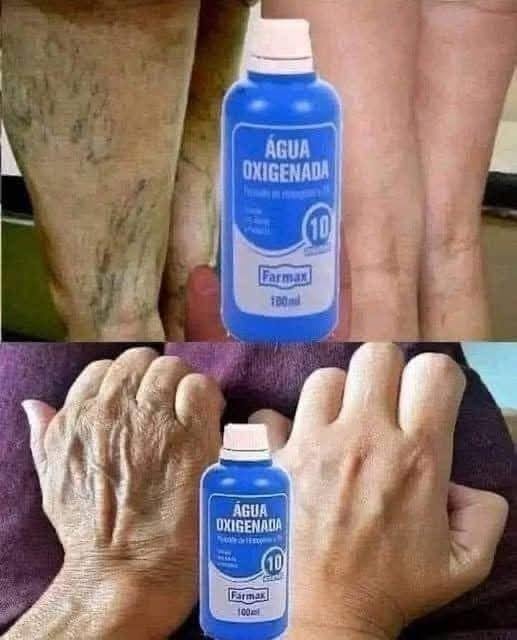 Increíbles usos del agua oxigenada que seguro no conocías. truco