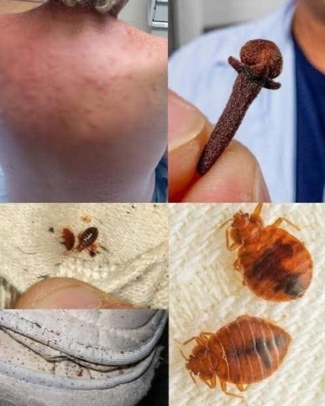 No dejes que los ácaros en tu cama y ropa te coman vivo! Rocíales esto y no volverás a saber de ellos