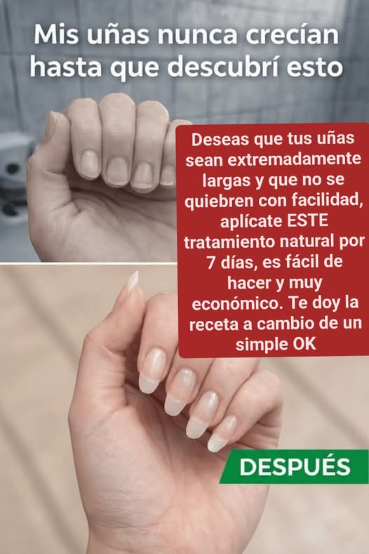 Logré Que Mis Uñas Crecieran Sin Control Después De Preparar Esta Receta Natural