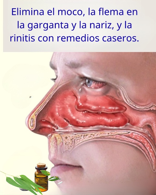 Mucosidad y Flemas: Remedios Caseros Eficaces