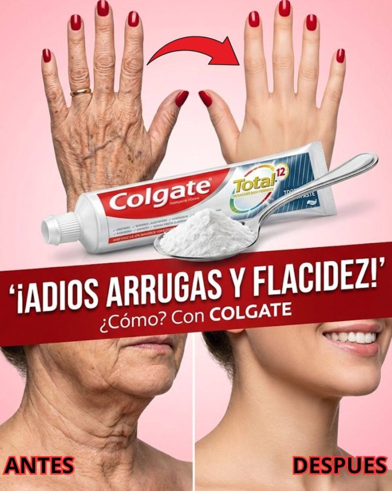Parece que me hice una cirugía estética: El remedio casero que se usa para mejorar la apariencia de las arrugas y manchas oscuras en manos y brazos. Para seguir recibiendo mis recetas, solo tienes que decir…¡Gracias!