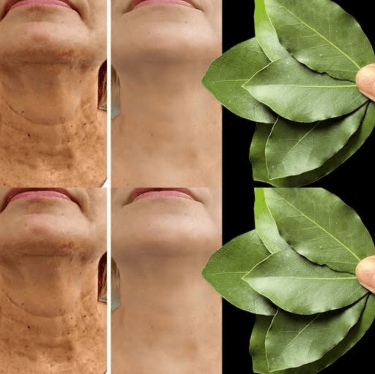 ¿Es el laurel 100.000 veces más efectivo que el bótox? | Eliminador de arrugas natural, ¡incluso a los 70!