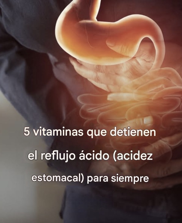 5 vitaminas que previenen el reflujo ácido (acidez estomacal)