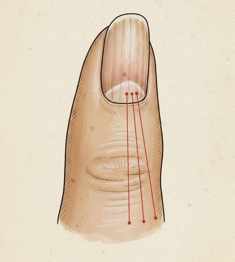 Si tienes líneas en las uñas, significa que tienes ca…Ver más