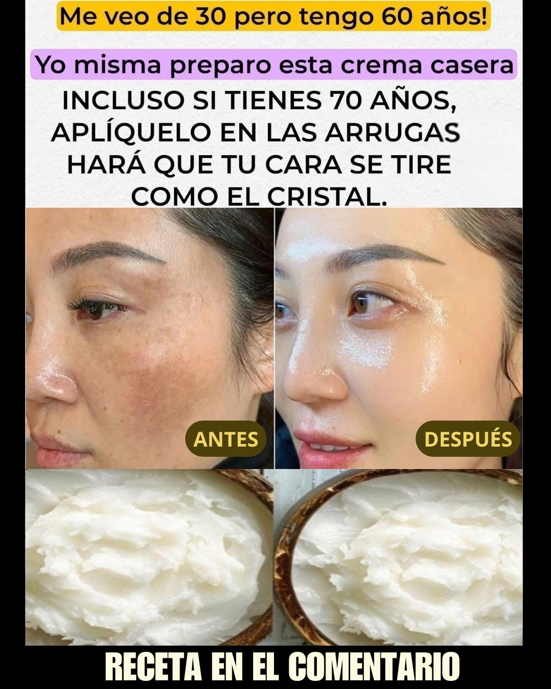 ,Prepara la crema de bicarbonato, ponla antes de dormir. Adiós arrugas y manc..ver mas. Para seguir recibiendo mis recetas, solo debes decir algo… ¡Gracias!