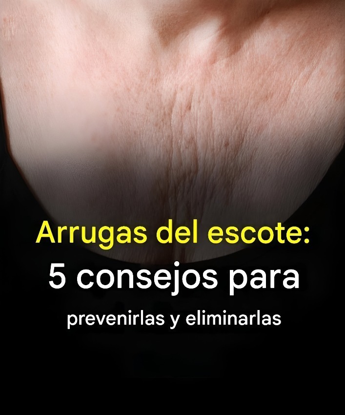 Arrugas del escote: 5 consejos para prevenirlas y eliminarlas
