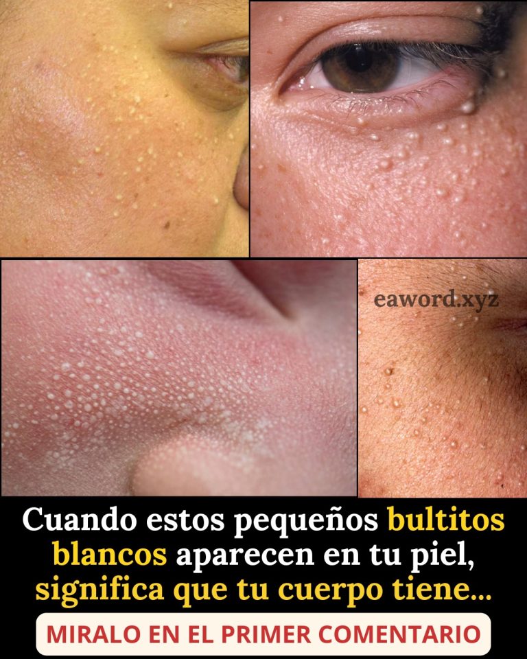 Si te están saliendo estos granitos blancos es porque… Ver más