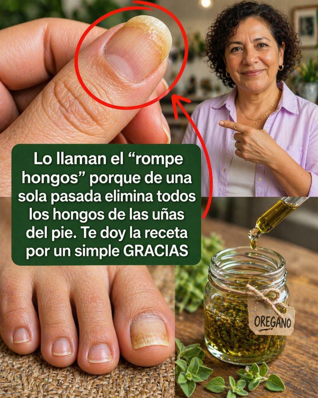 Tratamiento casero Orégano para los Hongos de las Uñas