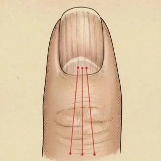 Si tienes las uñas con estas lineas debes poner atención