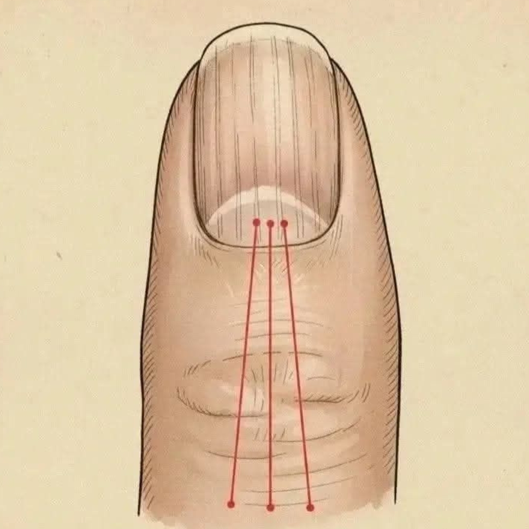 Si tienes las uñas con estas lineas debes poner atención