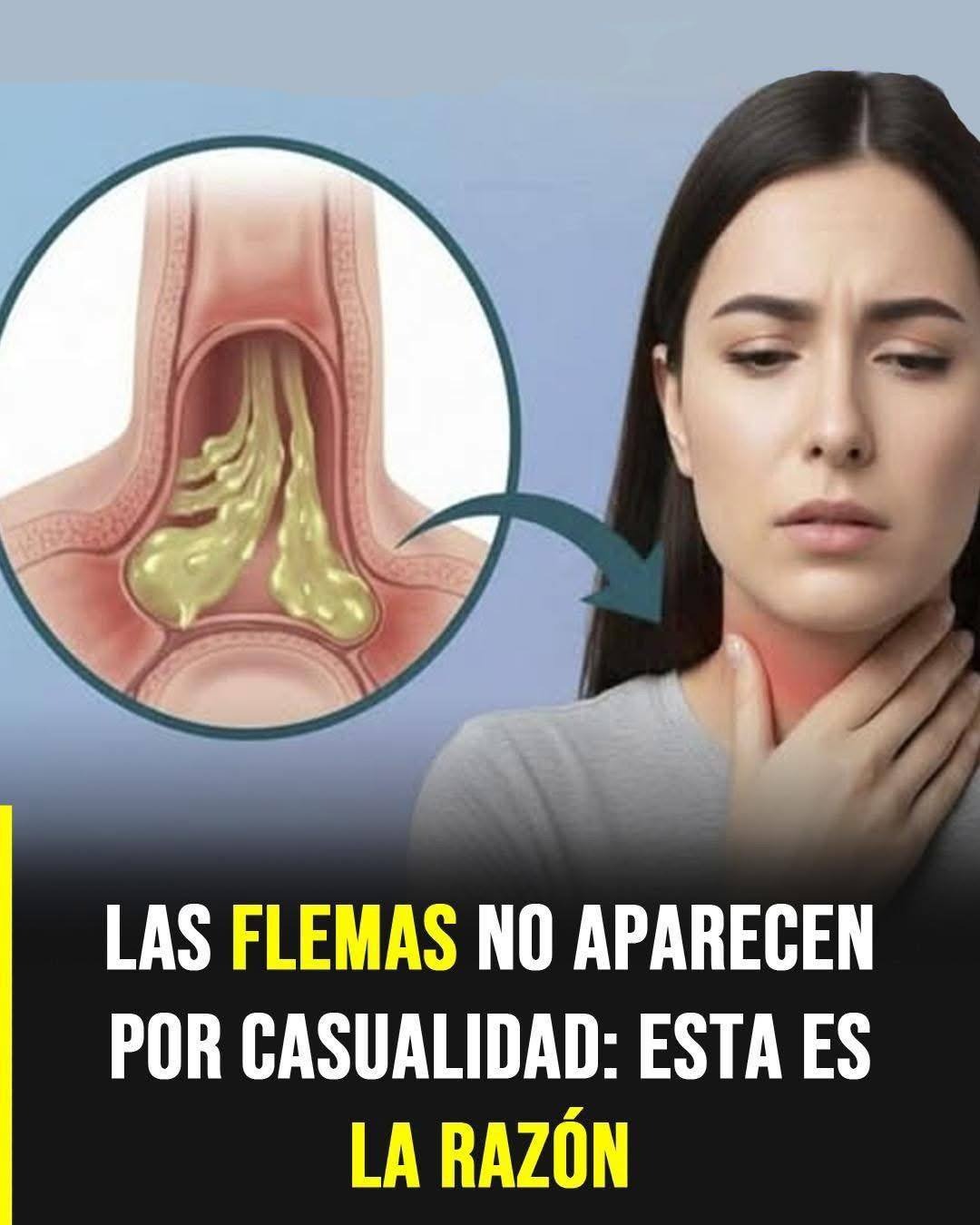 ¿Flemas Constantes en la Garganta y No Sabes Por Qué? Estas Pueden Ser las Causas