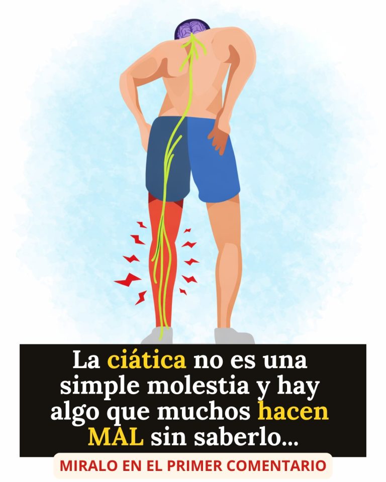 Cómo Acabar con el Dolor de Ciática: La Guía Completa para Aliviarlo de Forma Efectiva