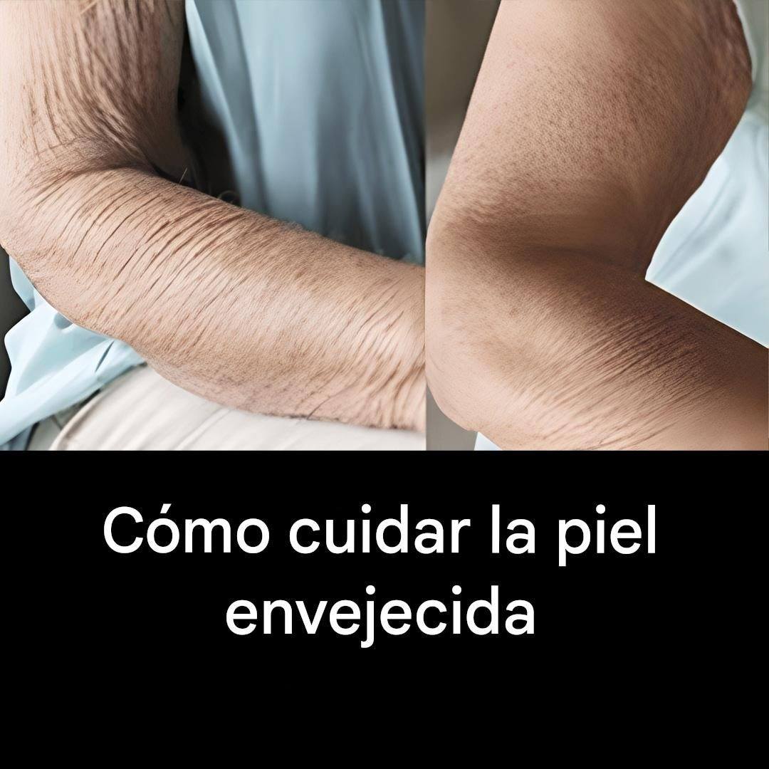 El secreto para cuidar tu piel envejecida