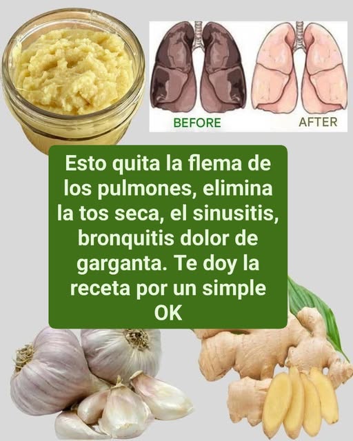Los Mejores Remedios Caseros para Eliminar Flema y Purificar los Pulmones