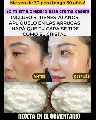 ,Prepara la crema de bicarbonato, ponla antes de dormir. Adiós arrugas y manc..ver mas. Para seguir recibiendo mis recetas, solo debes decir algo… ¡Gracias!