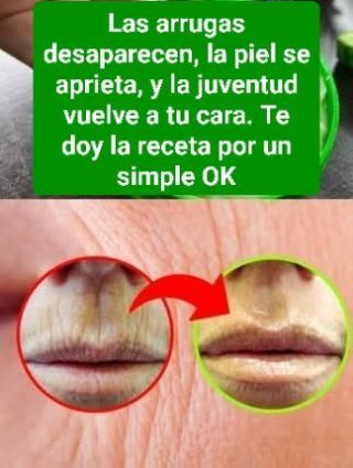 Mujer Aplico Esto En Sus Arrugas Y En 5 Minutos Quedo Espantada | Huevo Y Vaselina Para Eliminar Las Arrugas