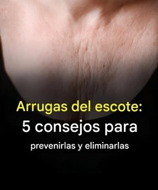Arrugas del escote: 5 consejos para prevenirlas y eliminarlas