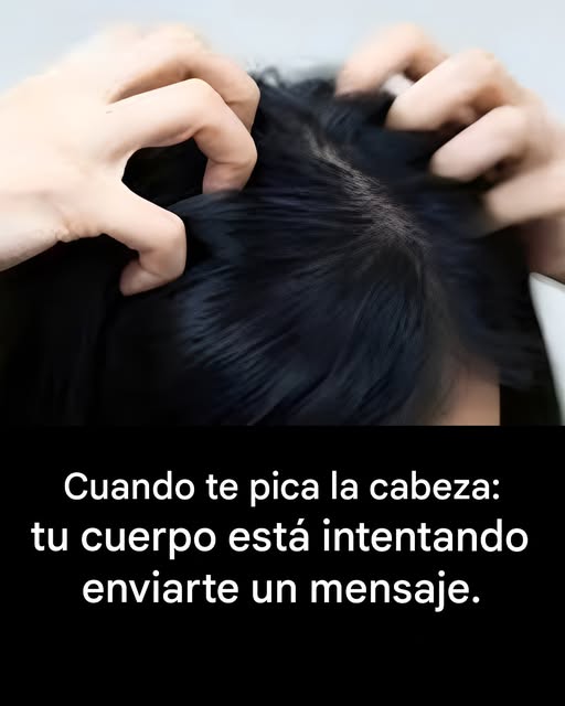 ¿Te pica la cabeza? Estas son las principales causas.