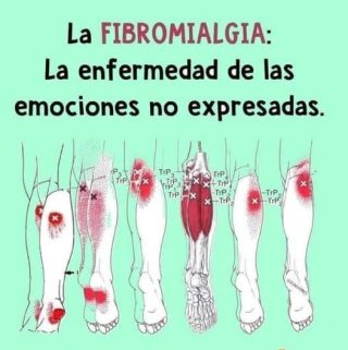 Fibromialgia: Síntomas, Causas y Tratamientos