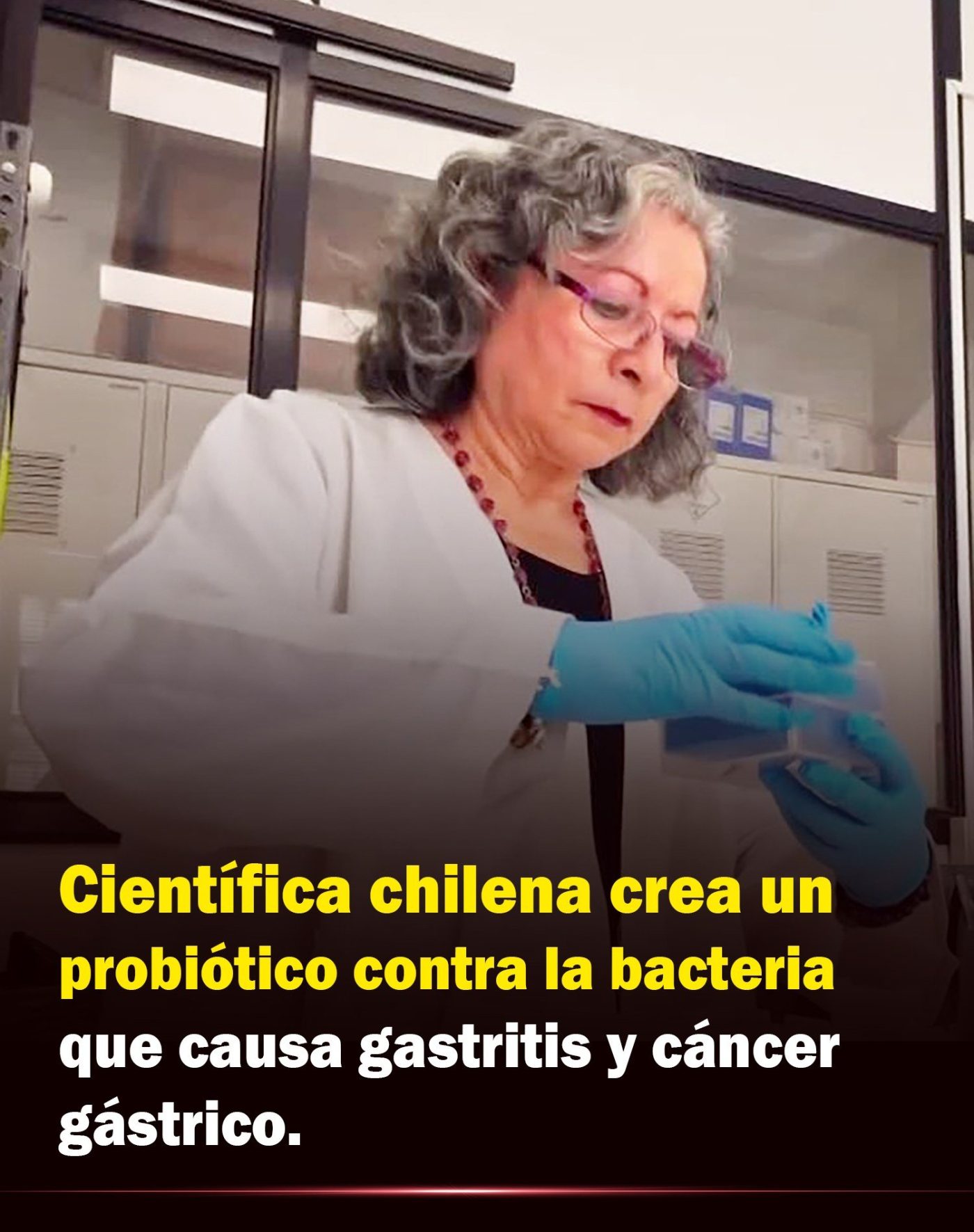 Científica chilena crea el primer probiótico capaz de eliminar la bacteria causante de la gastritis.