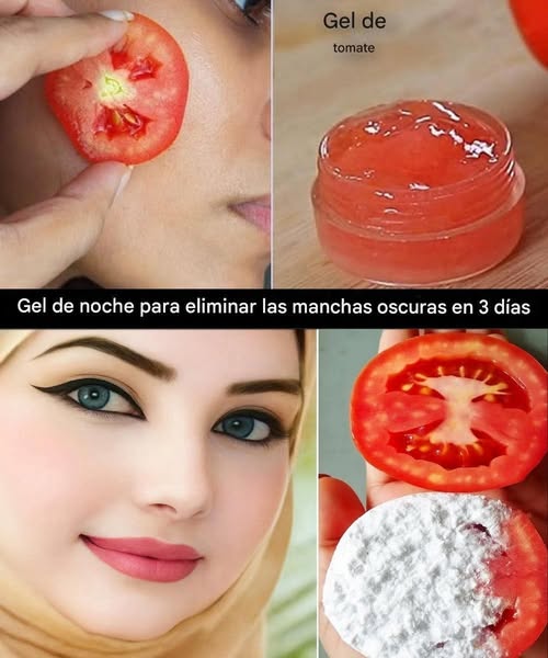 Descubre Cómo Eliminar el Acné de Forma Natural con Tomate