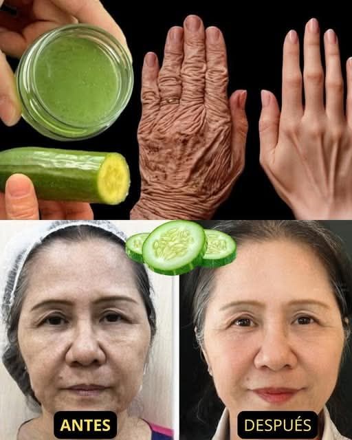 Cuida tu piel del sol con estos simples consejos. Tu piel lo agradecerá.