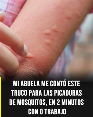 Especialistas alertan sobre el peligro del truco viral de la cuchara caliente contra las picaduras de mosquito