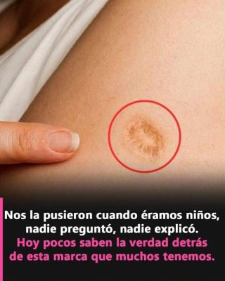 ¿Tienes una marca redonda en el brazo? Esto revela un detalle histórico que pocos conocen