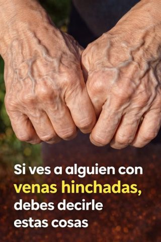 Venas azules en la piel: por qué aparecen cuándo preocuparse y cómo cuidar tu salud vascular